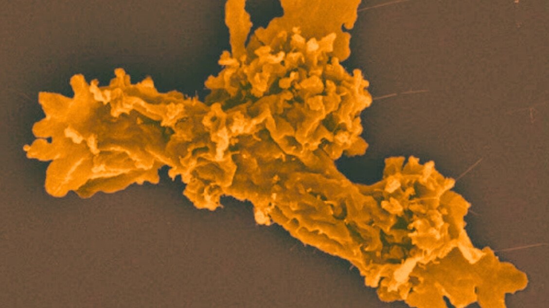 Огненная амеба обнаружена, растет и размножается при температуре 63 градуса – Природа